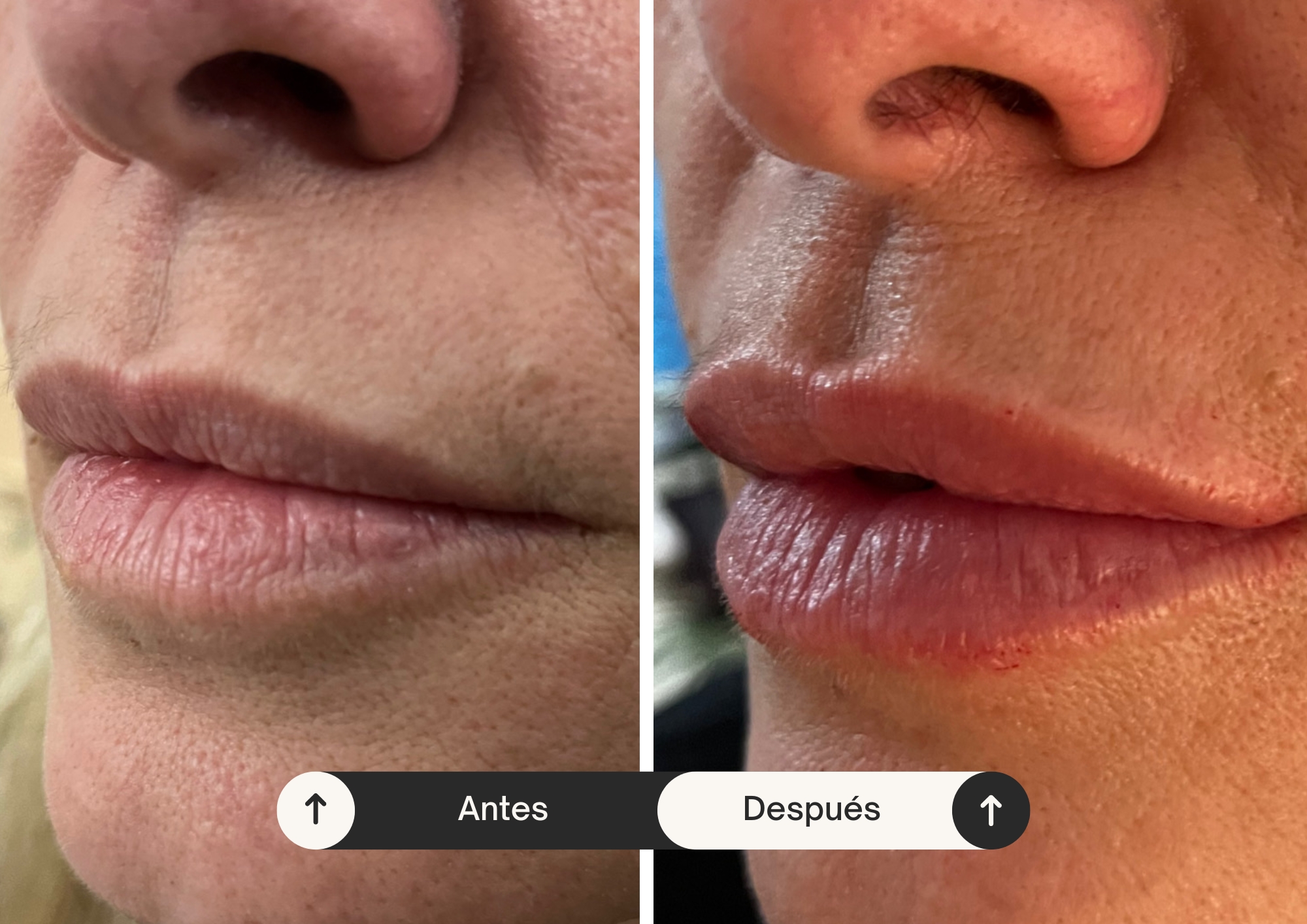 Medicina Estética | Tratamientos faciales