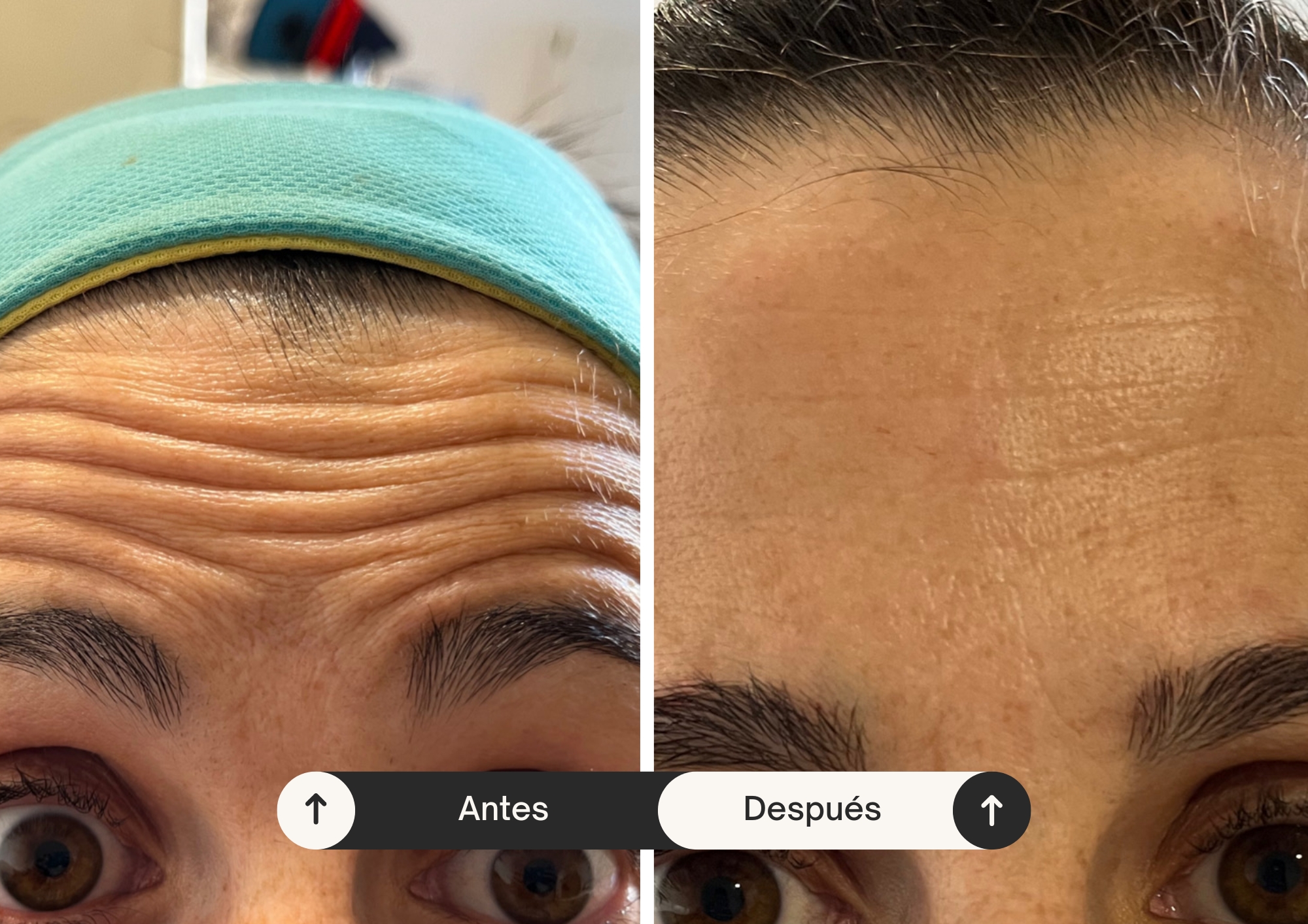 Dra. Melody Gutiérrez | Tratamiento Facial