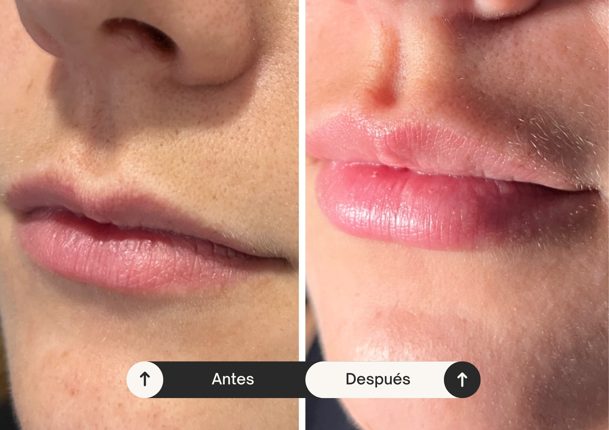 Medicina Estética - Dra. Melody Rodriguez